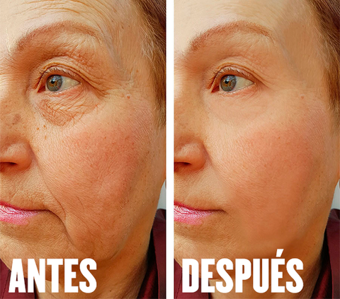 REJUVENECEDOR FACIAL ULTRASÓNICO